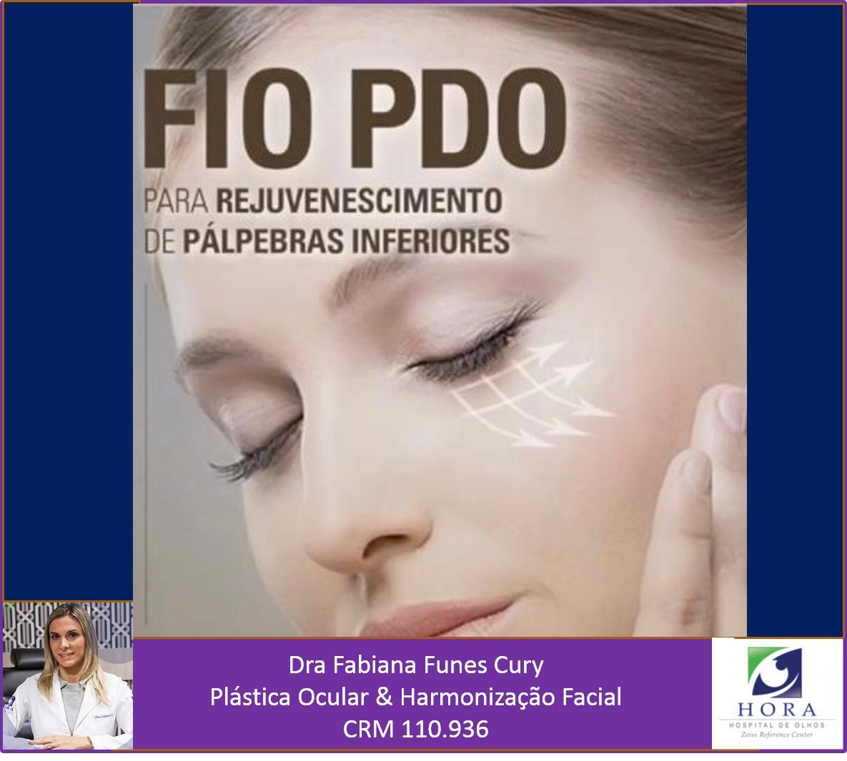 Fios de PDO